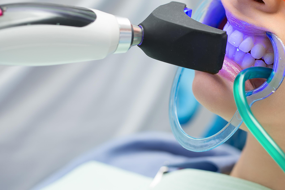 歯のクリーニングにも対応