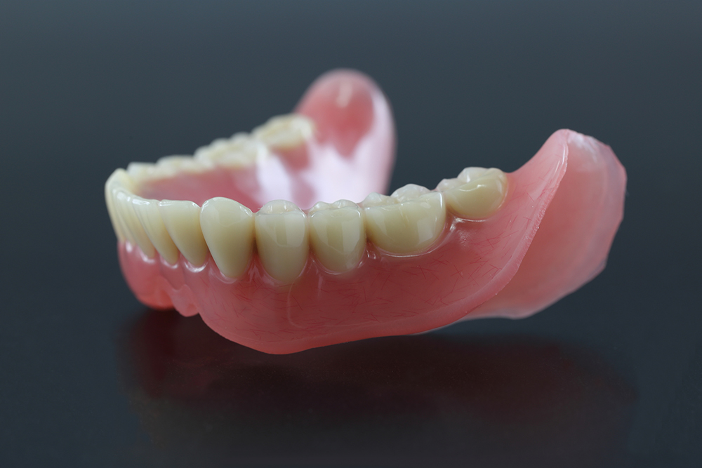 保険素材の入れ歯治療にも柔軟対応